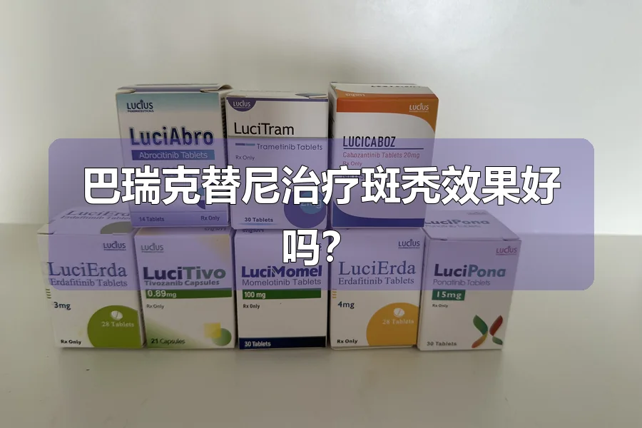 巴瑞克替尼治疗斑秃效果好吗?